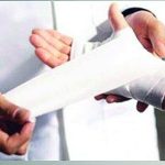 travmatizm 6 mesyacev A e1770965621674